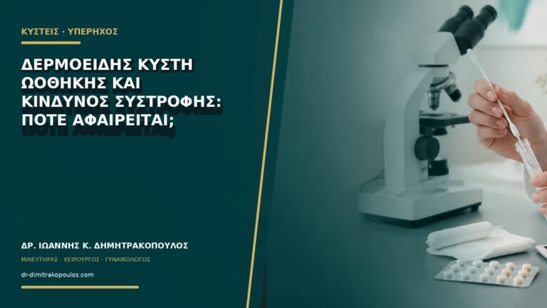 Δερμοειδής κύστη ωοθήκης και κίνδυνος συστροφής: πότε αφαιρείται;