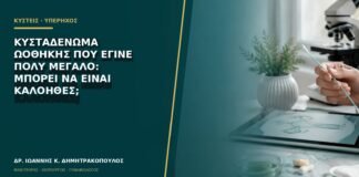 Κυσταδένωμα ωοθήκης που έγινε πολύ μεγάλο: μπορεί να είναι καλοήθες;