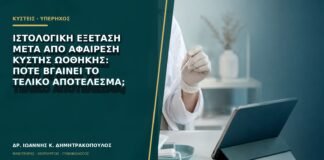 Ιστολογική εξέταση μετά από αφαίρεση κύστης ωοθήκης: πότε βγαίνει το τελικό αποτέλεσμα;