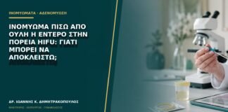 Ινομύωμα πίσω από ουλή ή έντερο στην πορεία HIFU: γιατί μπορεί να αποκλειστώ;
