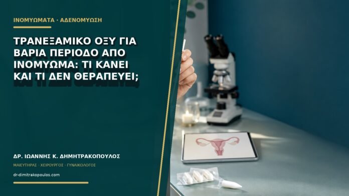 gynaikologikes-ypiresies-b69-32 Τρανεξαμικό οξύ για βαριά περίοδο από ινομύωμα: τι κάνει και τι δεν θεραπεύει;