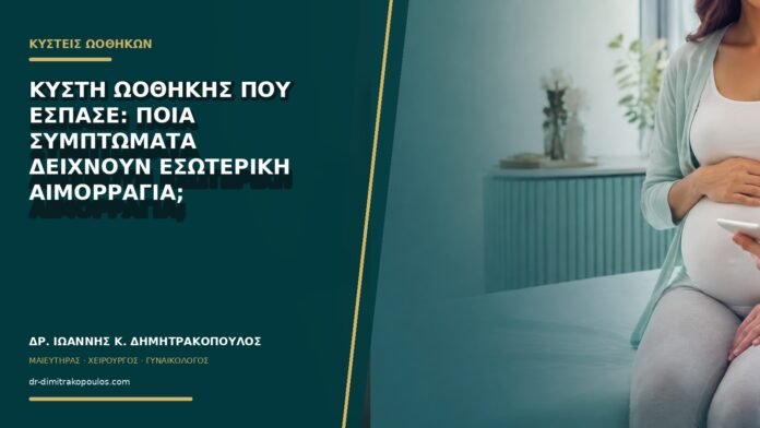 Κύστη ωοθήκης που έσπασε: ποια συμπτώματα δείχνουν εσωτερική αιμορραγία;