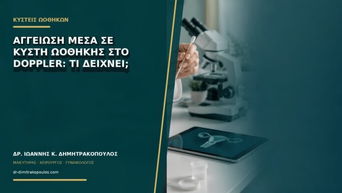 gynaikologikes-ypiresies-b72-20 Αγγείωση μέσα σε κύστη ωοθήκης στο Doppler: τι δείχνει;