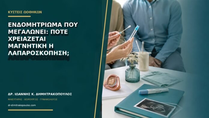 Ενδομητρίωμα που μεγαλώνει: πότε χρειάζεται μαγνητική ή λαπαροσκόπηση;