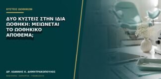 Δύο κύστεις στην ίδια ωοθήκη: μειώνεται το ωοθηκικό απόθεμα;