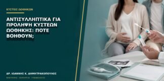 Αντισυλληπτικά για πρόληψη κύστεων ωοθήκης: πότε βοηθούν;