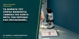 Τα νήματα του σπιράλ φαίνονται ξαφνικά πιο κοντά μετά την περίοδο: έχει μετακινηθεί;