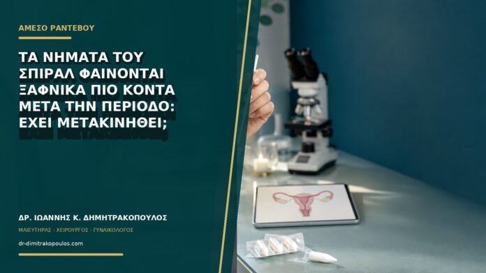 Τα νήματα του σπιράλ φαίνονται ξαφνικά πιο κοντά μετά την περίοδο: έχει μετακινηθεί;