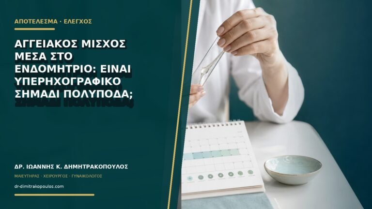 Αγγειακός μίσχος μέσα στο ενδομήτριο: είναι υπερηχογραφικό σημάδι πολύποδα;