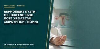 Δερμοειδής κύστη με ηχογενή όζο: πότε χρειάζεται χειρουργική γνώμη;