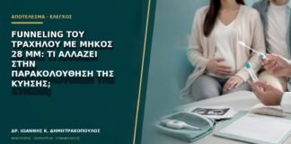 Funneling του τραχήλου με μήκος 28 mm: τι αλλάζει στην παρακολούθηση της κύησης;