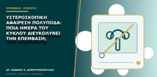 Υστεροσκοπική αφαίρεση πολύποδα: ποια ημέρα του κύκλου διευκολύνει την επέμβαση;
