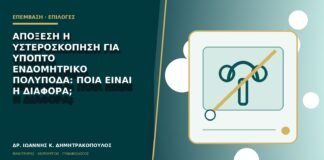Απόξεση ή υστεροσκόπηση για ύποπτο ενδομητρικό πολύποδα: ποια είναι η διαφορά;