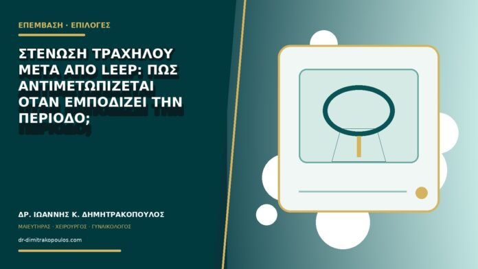 Στένωση τραχήλου μετά από LEEP: πώς αντιμετωπίζεται όταν εμποδίζει την περίοδο;