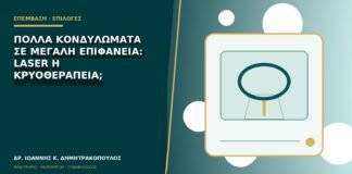 Πολλά κονδυλώματα σε μεγάλη επιφάνεια: laser ή κρυοθεραπεία;