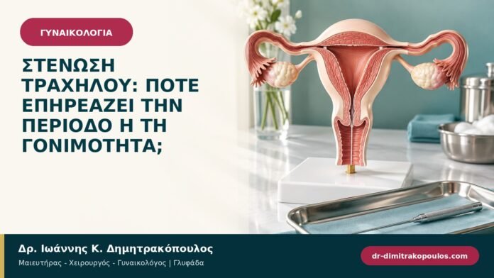 gynaikologikes-ypiresies-b94-14.jpg Στένωση τραχήλου: πότε επηρεάζει την περίοδο ή τη γονιμότητα;