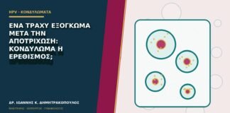 Ένα τραχύ εξόγκωμα μετά την αποτρίχωση: κονδύλωμα ή ερεθισμός;