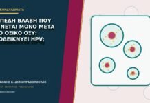 Επίπεδη βλάβη που φαίνεται μόνο μετά από οξικό οξύ: αποδεικνύει HPV; Επίπεδη βλάβη που φαίνεται μόνο μετά από οξικό οξύ: αποδεικνύει HPV;