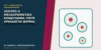 Σκούρο ή μελαχρωματικό κονδύλωμα: πότε χρειάζεται βιοψία;