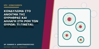 Κονδύλωμα στο άνοιγμα της ουρήθρας και αλλαγή στη ροή των ούρων: τι γίνεται;
