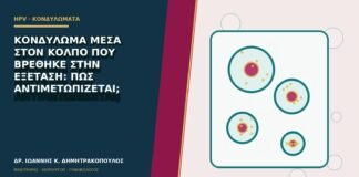 Κονδύλωμα μέσα στον κόλπο που βρέθηκε στην εξέταση: πώς αντιμετωπίζεται;