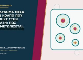 Κονδύλωμα μέσα στον κόλπο που βρέθηκε στην εξέταση: πώς αντιμετωπίζεται;