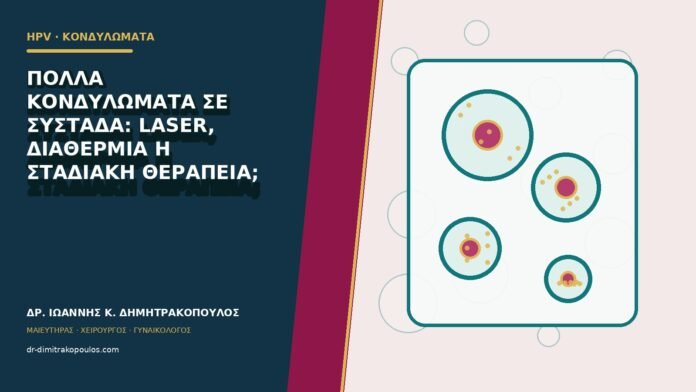 Πολλά κονδυλώματα σε συστάδα: laser, διαθερμία ή σταδιακή θεραπεία;