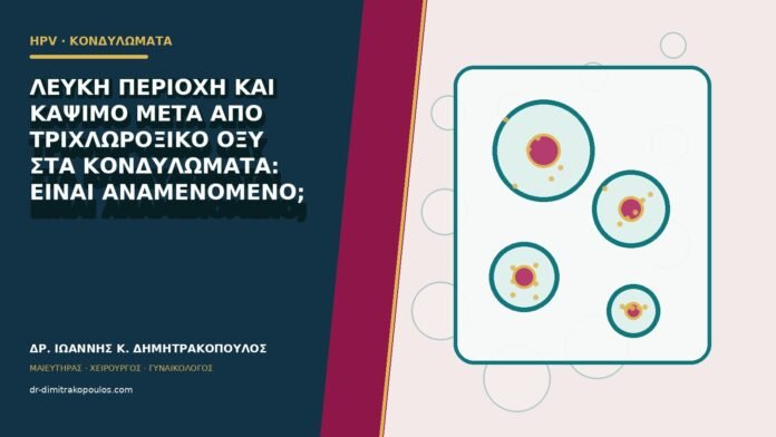 hpv-kondylomata-b80-11 Λευκή περιοχή και κάψιμο μετά από τριχλωροξικό οξύ στα κονδυλώματα: είναι αναμενόμενο;