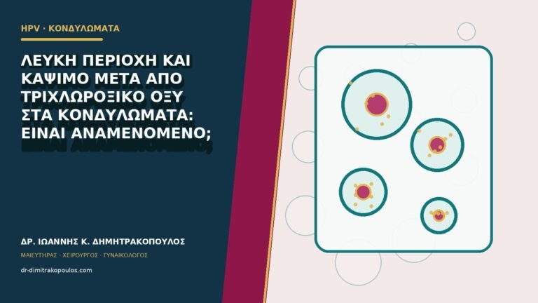 Λευκή περιοχή και κάψιμο μετά από τριχλωροξικό οξύ στα κονδυλώματα: είναι αναμενόμενο;