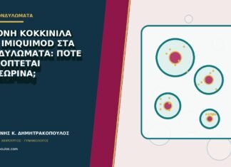 Έντονη κοκκινίλα από imiquimod στα κονδυλώματα: πότε διακόπτεται προσωρινά;