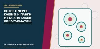Πόσες ημέρες κλείνει η πληγή μετά από laser κονδυλωμάτων;