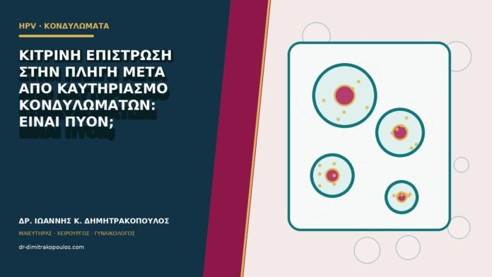 Κίτρινη επίστρωση στην πληγή μετά από καυτηριασμό κονδυλωμάτων: είναι πύον;