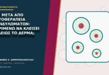 Σεξ μετά από κρυοθεραπεία κονδυλωμάτων: περιμένω να κλείσει τελείως το δέρμα;