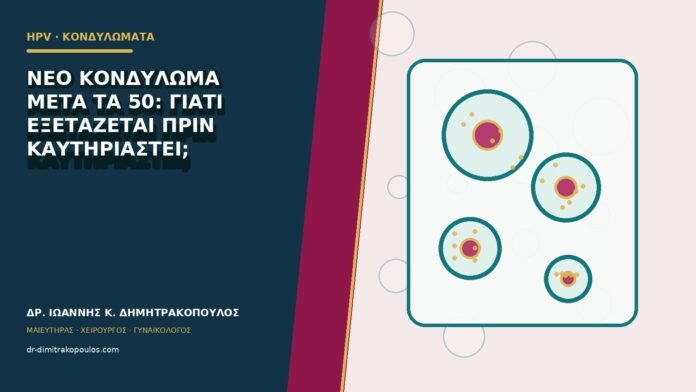 hpv-kondylomata-b80-50 Νέο κονδύλωμα μετά τα 50: γιατί εξετάζεται πριν καυτηριαστεί;