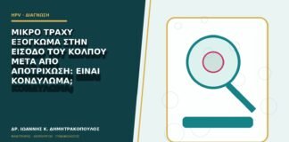 Μικρό τραχύ εξόγκωμα στην είσοδο του κόλπου μετά από αποτρίχωση: είναι κονδύλωμα;