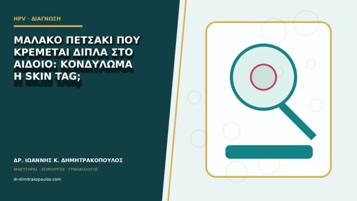 hpv-kondylomata-b82-03 Μαλακό πετσάκι που κρέμεται δίπλα στο αιδοίο: κονδύλωμα ή skin tag;