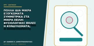 Πολλά ίδια μικρά εξογκώματα συμμετρικά στα μικρά χείλη: φυσιολογικές θηλές ή κονδυλώματα;