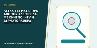Λευκά στίγματα γύρω από την κλειτορίδα με κνησμό: HPV ή δερματοπάθεια;
