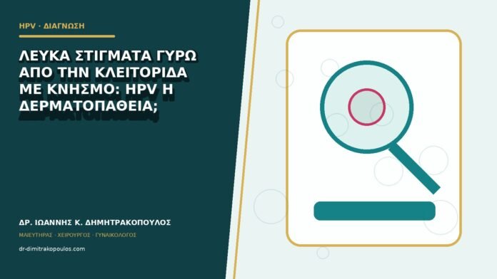 hpv-kondylomata-b82-11 Λευκά στίγματα γύρω από την κλειτορίδα με κνησμό: HPV ή δερματοπάθεια;