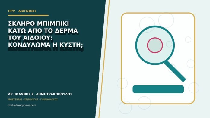 hpv-kondylomata-b82-14 Σκληρό μπιμπίκι κάτω από το δέρμα του αιδοίου: κονδύλωμα ή κύστη;
