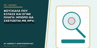 Φουσκάλα που έσπασε και έγινε πληγή: μπορεί να σχετίζεται με HPV;