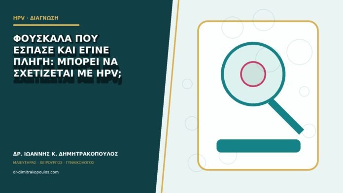 hpv-kondylomata-b82-15 Φουσκάλα που έσπασε και έγινε πληγή: μπορεί να σχετίζεται με HPV;