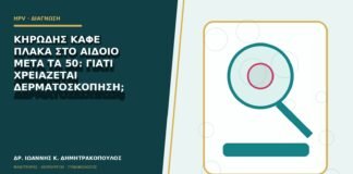 Κηρώδης καφέ πλάκα στο αιδοίο μετά τα 50: γιατί χρειάζεται δερματοσκόπηση;