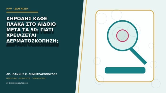 hpv-kondylomata-b82-26 Κηρώδης καφέ πλάκα στο αιδοίο μετά τα 50: γιατί χρειάζεται δερματοσκόπηση;