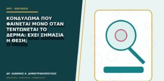 Κονδύλωμα που φαίνεται μόνο όταν τεντώνεται το δέρμα: έχει σημασία η θέση;