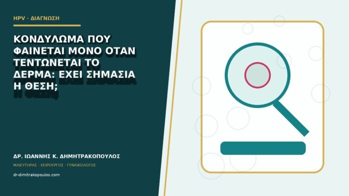 hpv-kondylomata-b82-43 Κονδύλωμα που φαίνεται μόνο όταν τεντώνεται το δέρμα: έχει σημασία η θέση;