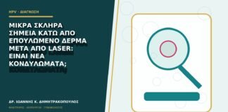 Μικρά σκληρά σημεία κάτω από επουλωμένο δέρμα μετά από laser: είναι νέα κονδυλώματα;