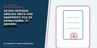 Λευκή περιοχή αμέσως μετά την εφαρμογή TCA σε κονδύλωμα: τι δείχνει;