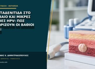 Ιδρωταδενίτιδα στο εφήβαιο και μικρές βλάβες HPV: πώς ξεχωρίζουν οι βαθιοί όζοι;
