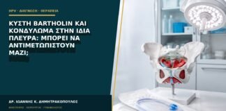 Κύστη Bartholin και κονδύλωμα στην ίδια πλευρά: μπορεί να αντιμετωπιστούν μαζί;